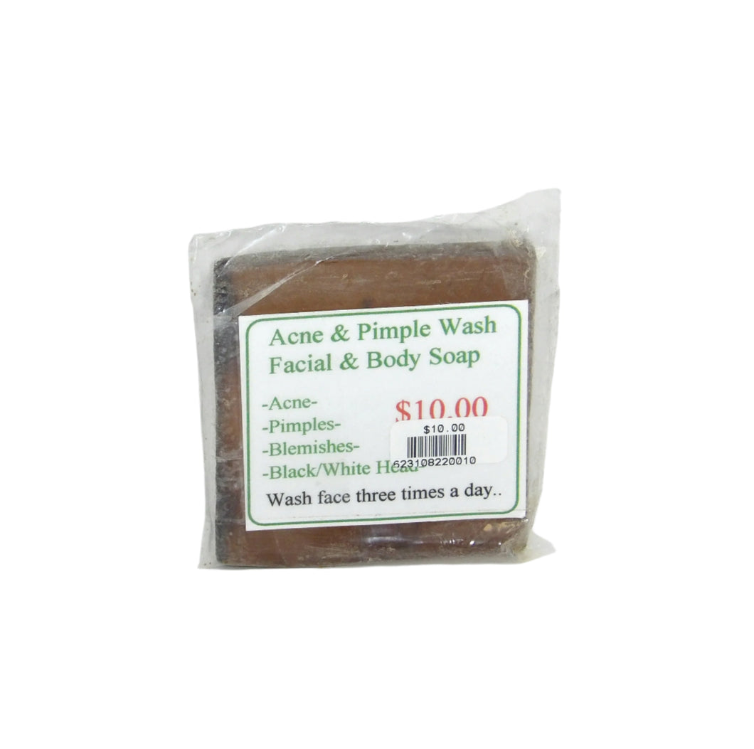 A bar of natural acne and pimple wash soap in clear plastic packaging with a label that includes the product name, price, and information that it helps with blackheads, blemishes, and acne.